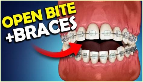 Brace Yourself For A Grin!