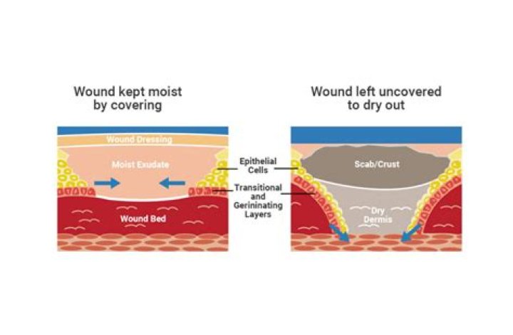 Should cuts be kept moist or dry?