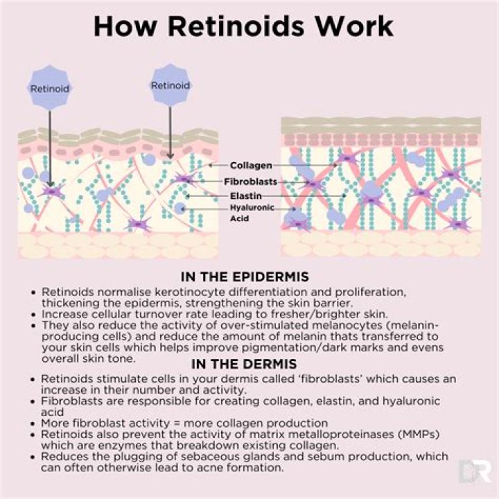 When do retinoids start working?